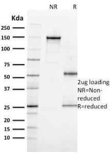 SDS-PAGE analysis of Anti-MiTF Antibody [MITF/915] under non-reduced and reduced conditions; showing intact IgG and intact heavy and light chains, respectively. SDS-PAGE analysis confirms the integrity and purity of the antibody