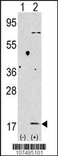 Anti-LC3 (APG8B) Rabbit Polyclonal Antibody