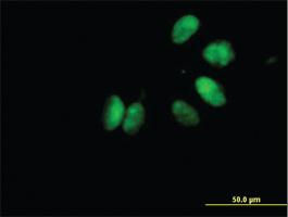 Anti-CHEK2 Mouse Polyclonal Antibody