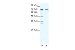 Anti-PRDM1 Rabbit Polyclonal Antibody