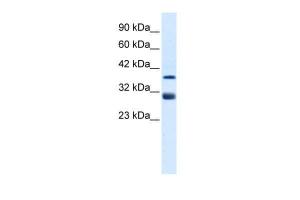 Anti-TAL1 Rabbit Polyclonal Antibody