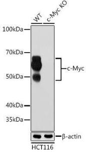 Western blot analysis of extracts from wild type (WT) and c-Myc knockout (KO) HCT116 cells, using Anti-c-Myc Antibody [ARC0412] (A307622) at 1:1000 dilution. The secondary Antibody was Goat Anti-Rabbit IgG H&L Antibody (HRP) at 1:10000 dilution