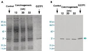 Anti-GSTP1 Mouse Monoclonal Antibody [clone: Usal-hGST-Pi-McAb-1]