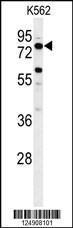 Anti-ACSBG2 Rabbit Polyclonal Antibody (APC (Allophycocyanin))