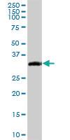 Anti-EPCAM Rabbit Polyclonal Antibody