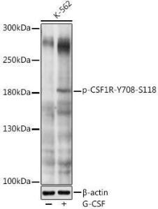 Western blot analysis of extracts of K-562 cells, using Anti-CSF-1-R (phospho Tyr708) Antibody (A11085) at 1:1,000 dilution