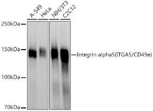 Western blot analysis of extracts of various cell lines, using Anti-Integrin alpha 5 Antibody (A305899) at 1:600 dilution. The secondary antibody was Goat Anti-Rabbit IgG H&L Antibody (HRP) at 1:10,000 dilution.