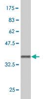 Anti-TADA2B Mouse Polyclonal Antibody