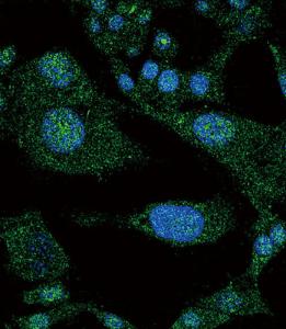 Anti-NOTCH3 Rabbit Polyclonal Antibody (HRP (Horseradish Peroxidase))