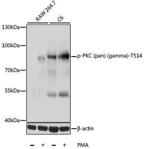 Western blot analysis of extracts of various cell lines, using Anti-pan PKC (phospho Thr514) Antibody (A11089) at 1:1,000 dilution. RAW 264. 7 cells were treated by PMA (200 nM) for 30 minutes. C6 cells were treated by PMA/TPA (200nM) for 30 minutes after serum-starvation overnight.