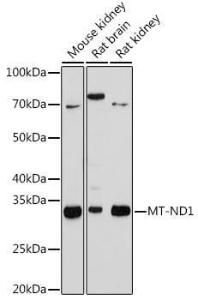 Anti-MT-ND1 Rabbit Monoclonal Antibody [clone: ARC1728]