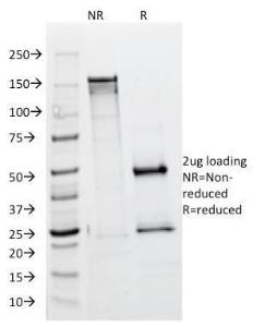 SDS-PAGE analysis of Anti-ALK Antibody [ALK/1504] under non-reduced and reduced conditions; showing intact IgG and intact heavy and light chains, respectively. SDS-PAGE analysis confirms the integrity and purity of the antibody.