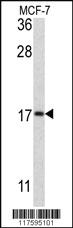 Anti-MAP1LC3B Rabbit Polyclonal Antibody