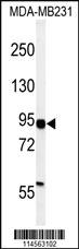 Anti-JAK1 Rabbit Polyclonal Antibody