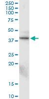 Anti-CTGF Mouse Monoclonal Antibody [clone: 2C11]