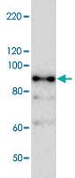 Anti-NBR1 Rabbit Polyclonal Antibody