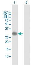 Anti-SNAI1 Rabbit Polyclonal Antibody