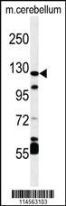 Anti-JAK1 Rabbit Polyclonal Antibody