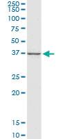 Anti-CTGF Mouse Monoclonal Antibody [clone: 2C11]