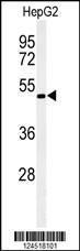 Anti-OPN1MW Rabbit Polyclonal Antibody (AP (Alkaline Phosphatase))