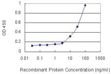 Anti-CTGF Mouse Monoclonal Antibody [clone: 2C11]