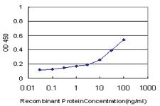 Anti-MYL6 Mouse Monoclonal Antibody [clone: 1G3]