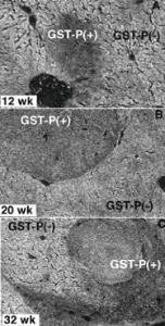 Anti-GSTP1 Mouse Monoclonal Antibody [clone: Usal-hGST-Pi-McAb-1]