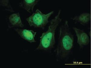 Anti-PPP3R1 Mouse Monoclonal Antibody [clone: 4E1]