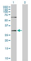 Anti-SNAI1 Rabbit Polyclonal Antibody