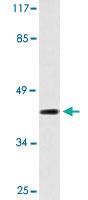 Anti-TBX1 Rabbit Polyclonal Antibody