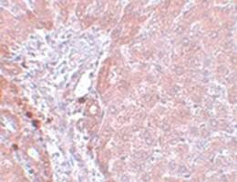 Anti-NDUFB9 Rabbit Polyclonal Antibody