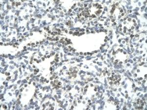 Anti-NFATC3 Rabbit Polyclonal Antibody