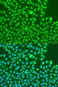 Immunofluorescence analysis of U2OS cells using Anti-DNA PKcs (phospho Ser2056) Antibody (A11093) at a dilution of 1:100. DAPI was used to stain the cell nuclei (blue).