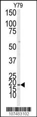 Anti-LC3 (APG8A/B) Rabbit Polyclonal Antibody