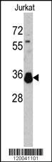 Anti-TYSY Rabbit Polyclonal Antibody