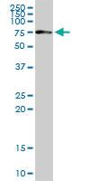 Anti-CHEK2 Rabbit Polyclonal Antibody