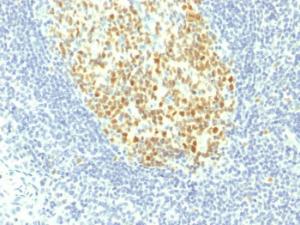 Immunohistochemical analysis of formalin-fixed, paraffin-embedded human tonsil using Anti-MCM7 Antibody [MCM7/1467]