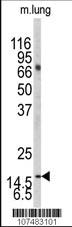 Anti-LC3 (APG8A/B) Rabbit Polyclonal Antibody