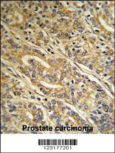 Anti-ACOT8 Rabbit Polyclonal Antibody