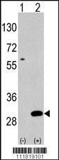 Anti-UBTD1 Rabbit Polyclonal Antibody (PE (Phycoerythrin))