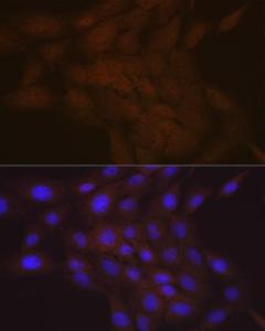 Immunofluorescence analysis of C6 cells using Anti-SMC4 Antibody [ARC2042] (A305900) at a dilution of 1:100 (40x lens) DAPI was used to stain the cell nuclei (blue)