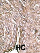 Anti-LC3 (APG8A/B) Rabbit Polyclonal Antibody