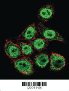 Anti-TYSY Rabbit Polyclonal Antibody