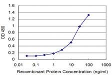 Anti-SNAI1 Mouse Monoclonal Antibody [clone: 2G11]