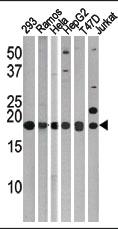 Anti-LC3 (APG8C) Rabbit Polyclonal Antibody