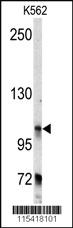 Anti-BICD2 Rabbit Polyclonal Antibody