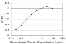 Anti-NBR1 Mouse Monoclonal Antibody [clone: 2E7]