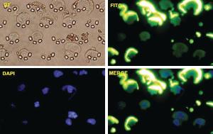 Anti-SNAI1 Mouse Monoclonal Antibody [clone: 2G11]