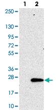 Anti-SEC11C Rabbit Polyclonal Antibody