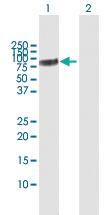 Anti-CHEK2 Rabbit Polyclonal Antibody